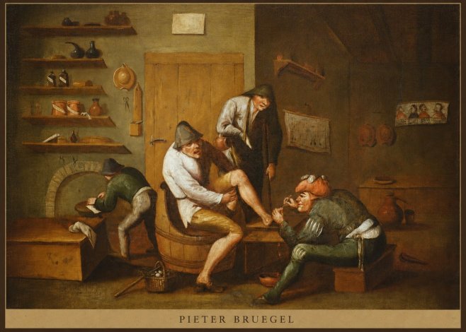 Pieter Bruegel The Foot Operation No5 - Poster